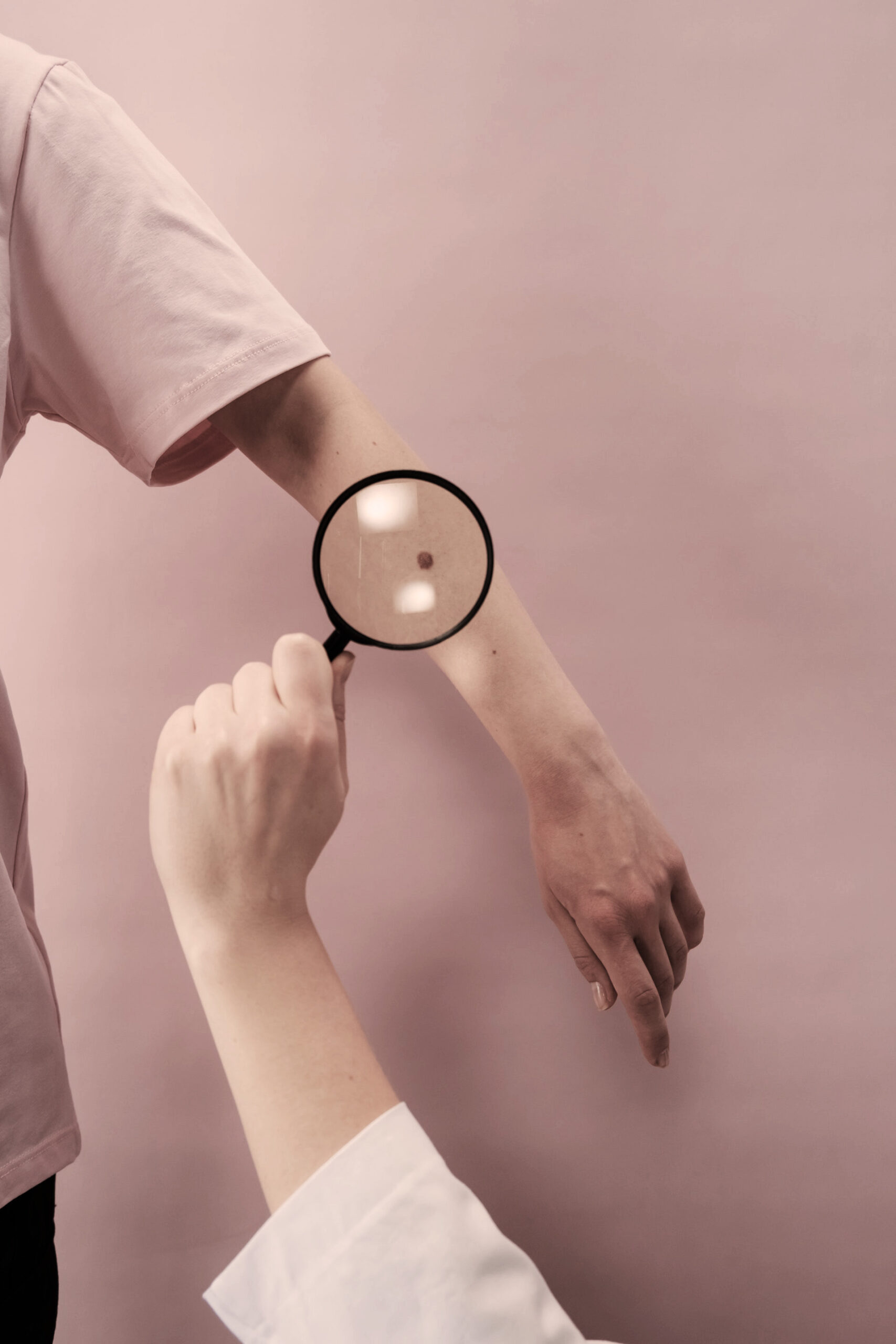 Detección del melanoma